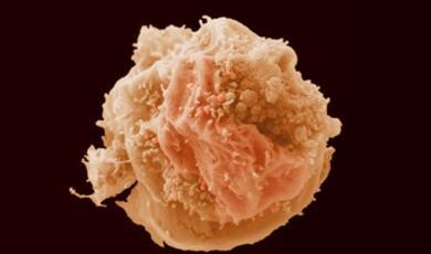 Image of a breast cancer cell