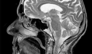 Sagittal view of a human head and neck from a medical scan