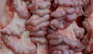 Human abdominal organs