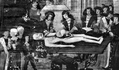 Medieval painting of surgery being performed