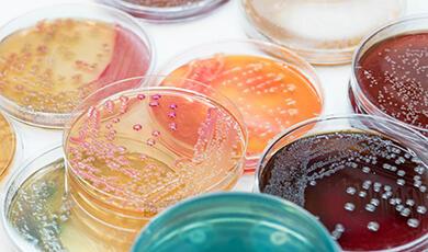 Petri dishes with coloured contents